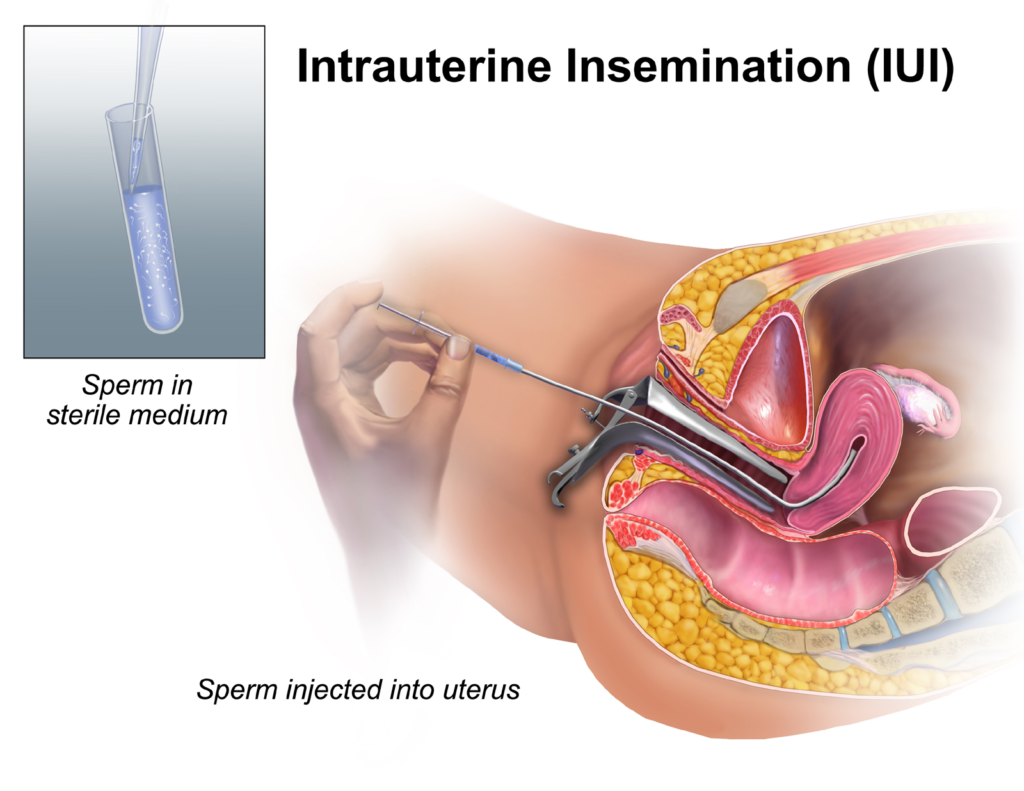 artificial insemination the fun way